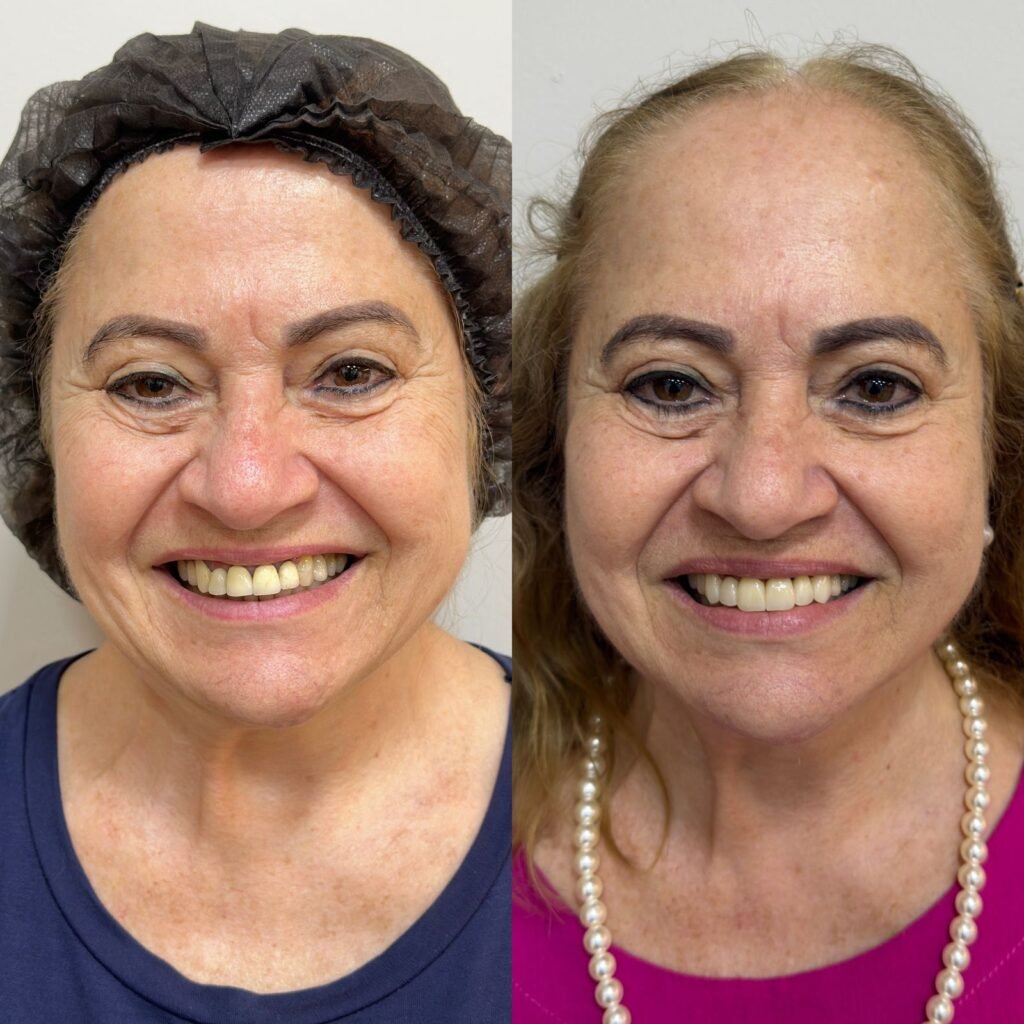 01 - ANTES E DEPOIS - 20.08 (1)